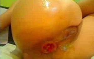 caca fist et prolapse plein de merde en webcam