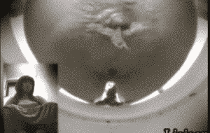 Gros plan toilette femme qui fait caca avec prolapse anal [video OK]
