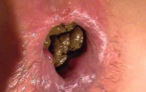 Sodomie à la merde avec femme montre son caca dans son anus dilaté