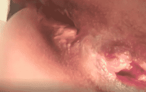 Gros plan d’un anus de femme qui chie [MAJ ok]