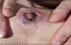 Mari nous montre l’anus dilaté de sa femme qui chie