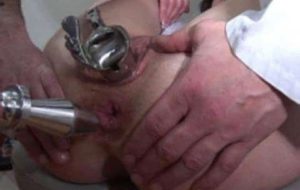 gynécologie extreme avec spéculum dilatation mme joyce mature