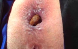 gros plan sur une énorme merde qui sort d’un anus