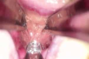 dans mon anus dilaté