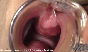 gyno speculum piss et gros plan