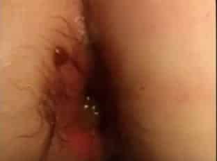 exploration de l’anus avec une camera