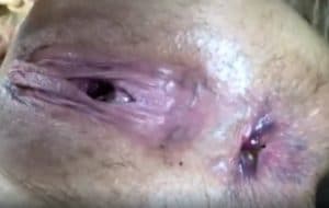 chatte et anus qui pete
