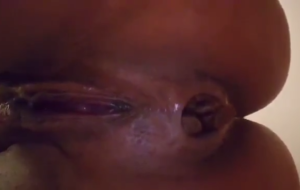 Gros Plan Sur L’anus D’Une Femme Qui Pete Et Chie