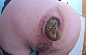 GROS PLAN ANUS D’UNE FEMME QUI CHIE